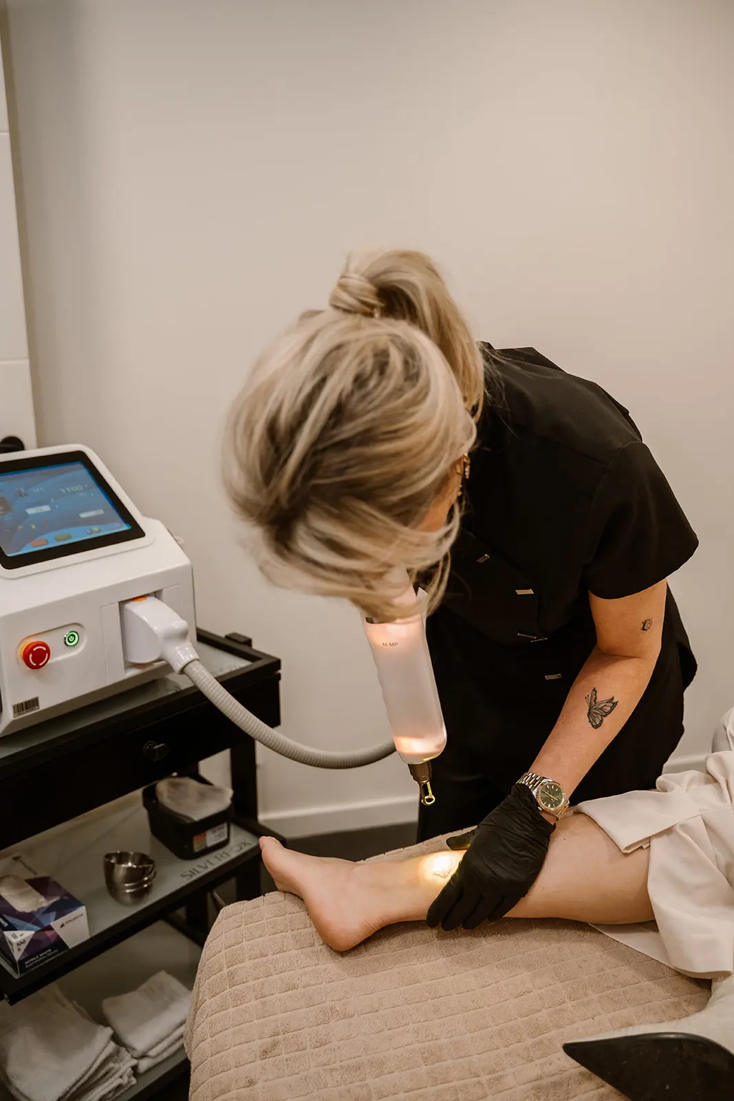 tattoo-verwijderen-behandeling-total-body-control